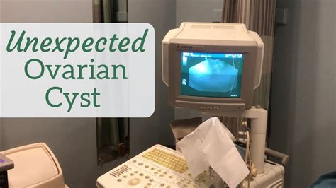 biopsy of ovarian cyst|what size ovarian cysts should be removed.
